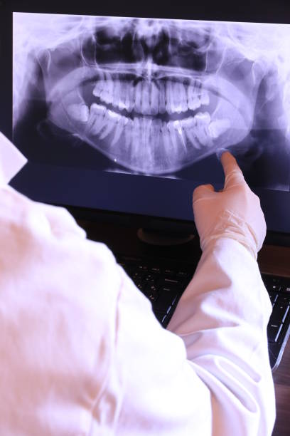 Best Emergency Root Canal Treatment in Gloster, MS